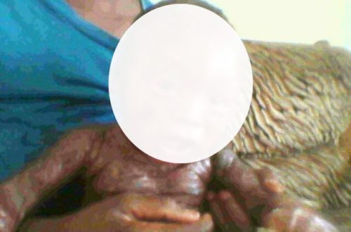 Article : Cause Humanitaire des twittos sénégalais: Il faut sauver l’enfant Mame Thierno