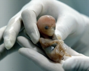 Article : Journal d&rsquo;une fillette qui n&rsquo;a jamais vu le jour