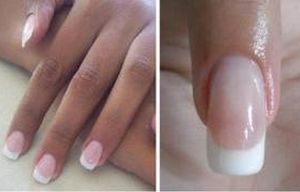 Article : Au nom de la beaut&eacute;