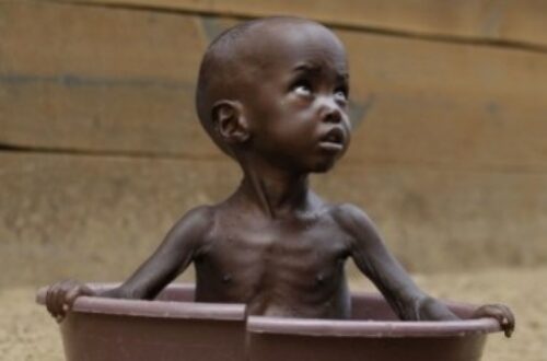 Article : La malnutrition au Niger
