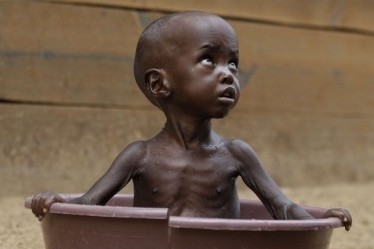 Article : La malnutrition au Niger